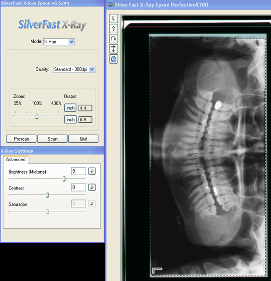 silverfast vs vuescan sharpness